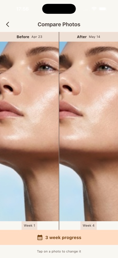 Progress photo comparison in ilysia